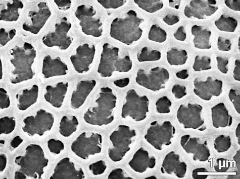exine surface (long-styled morph)