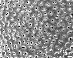 exine surface