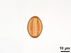 equatorial view,acetolyzed pollen