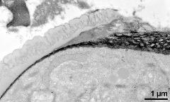 transition of aperture and interapertural zone (left)