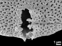 acetolyzed pollen,aperture