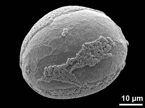 distal polar view
