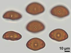 acetolyzed pollen,equatorial view