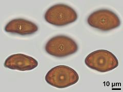 acetolyzed pollen,equatorial view