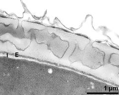 interapertural area of pollen wall, intine (I), endexine (E)