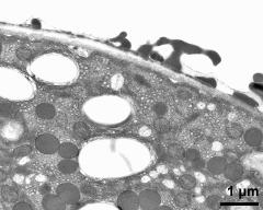 pollen wall at transition of aperture and interapertural area