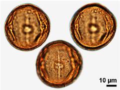 acetolyzed pollen,equatorial view