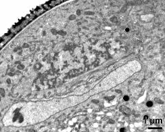 generative cell, vegetative nucleus with crystalline inclusion (protein bodies)