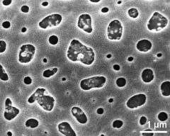 exine surface