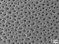 acetolyzed pollen,exine surface