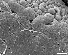 exine surface of hydrated tetrad