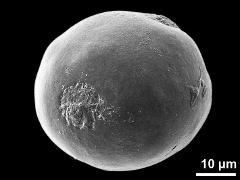 3-porate pollen grain