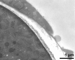 pollen wall at transition of aperture and interapertural area