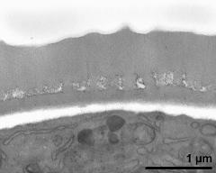 interapertural area of pollen wall