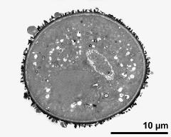 pollen grain in cross section