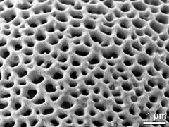 exine surface