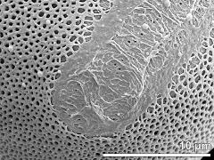 detail of sulcus