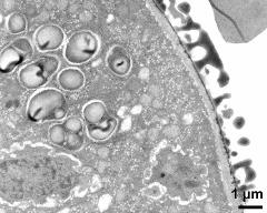 pollen wall at transition of aperture and interapertural area