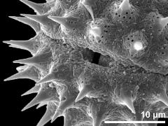 acetolyzed pollen,aperture