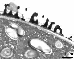 pollen wall at transition of aperture and interapertural area