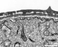 interapertural area of pollen wall