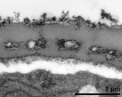 interapertural area of pollen wall