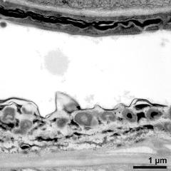pollen wall and tapetum cells with Ubisch bodies (asterisks)