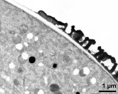 pollen wall at transition of aperture and interapertural area