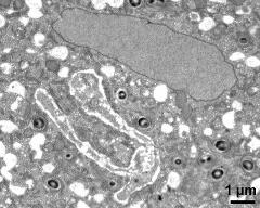 vegetative cell and sperm cells