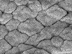 tetrads (forming massula)