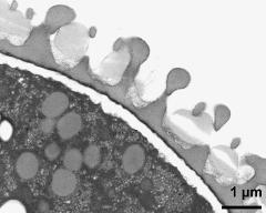 pollen wall; interapertural area