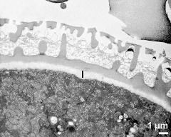 interapertural area of pollen wall, intine (I)