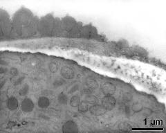 pollen wall at transition of aperture and interapertural area