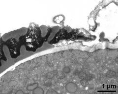 pollen wall at transition of aperture and interapertural area