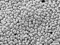 exine surface