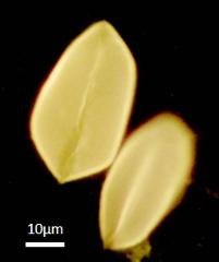 acetolyzed pollen,equatorial view