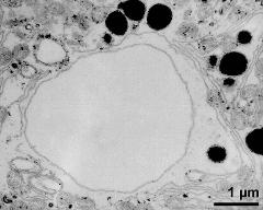 vegetative nucleus