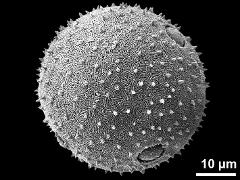tetraporate pollen grain (polar view)