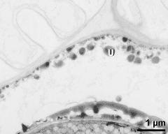 pollen wall (bottom) and tapetum cells with Ubisch bodies (U)