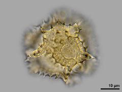 hydrated pollen,equatorial view