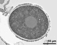 cross section of pollen grain