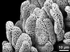 massulae (forming pollinium)