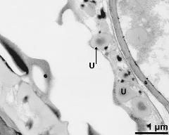 pollen wall (left) and tapetum cells with Ubisch bodies (U)