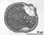 pollen grain in cross section