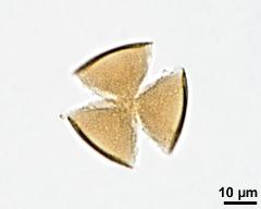 acetolyzed pollen, upper focus