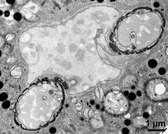 vegetative nucleus and two cuts of the generative cell