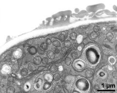 pollen wall, transition from aperture to interapertural area