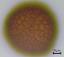 acetolyzed pollen