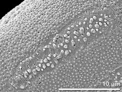 equatorial aperture (colpus)