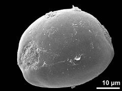 distal polar view